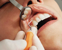 Dental examination image